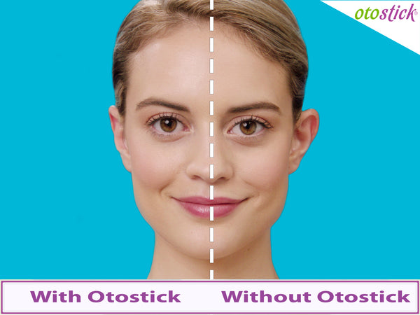 Otostick - Trade Pack of 10 x 8 Correctors