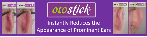 Otostick - Trade Pack of 10 x 8 Correctors